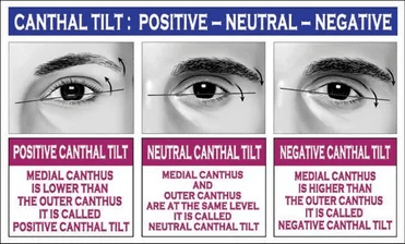 Negative Eye Shape